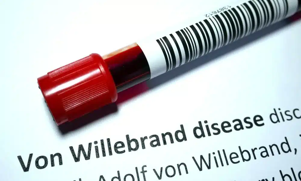 Blood Tube for Diagnosing Von Willebrand Disease
