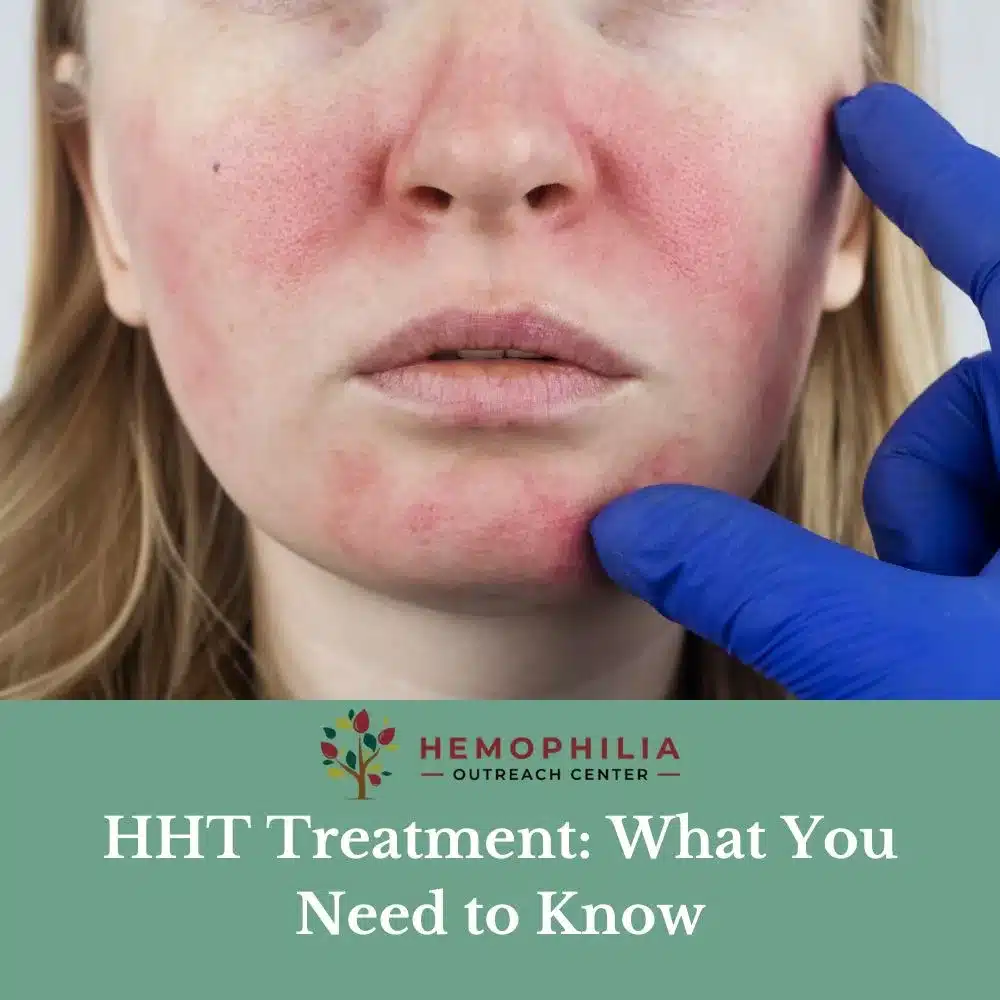 Introduction to “HHT Treatment: What You Need to Know”