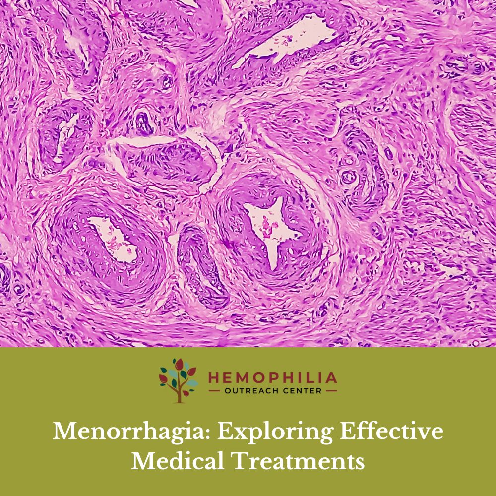 Menorrhagia: Exploring Effective Medical Treatments